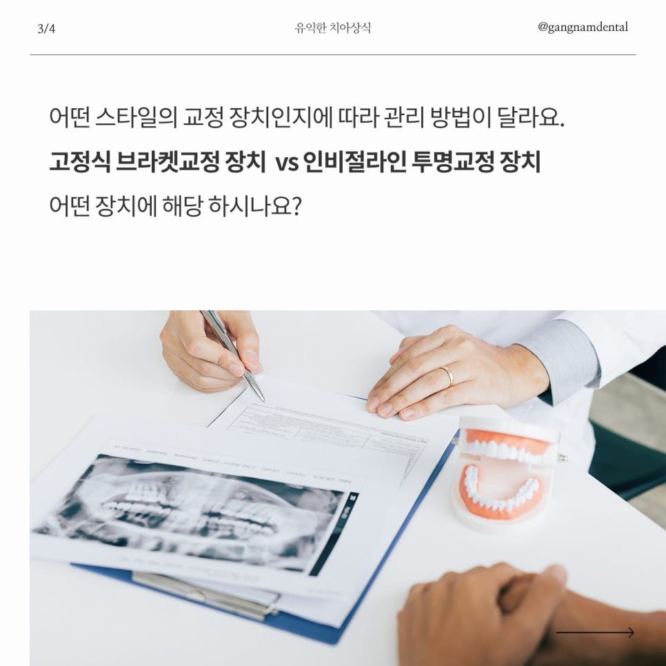 청소년 치아교정 관리의 중요성과 고정식 브라켓 교정&인비절라인 투명 치아 교정 양치하는 방법 관련 이미지 4