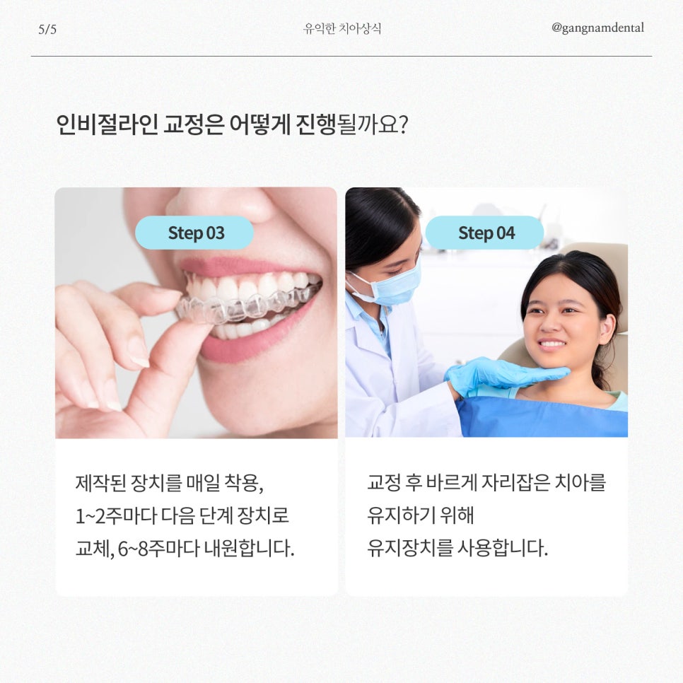강남역치과, 여름방학 앞두고 우리 아이 투명교정 인비절라인에 대해 고민하고 계신다면? 관련 이미지 6