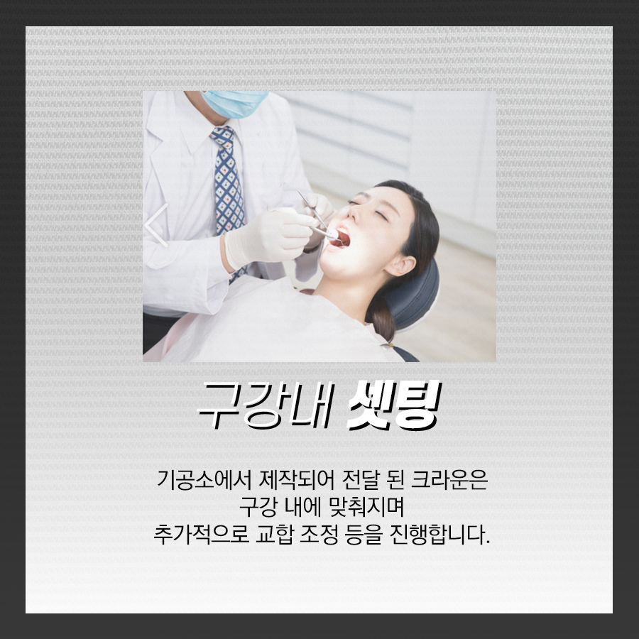 치아 크라운 과정, 어떤 순서로 진행이 될까? 관련 이미지 5