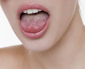 잇몸담배 시대, 니코틴 파우치 치과에서 경고하는 이유는? / 강남레옹치과 관련 이미지 4