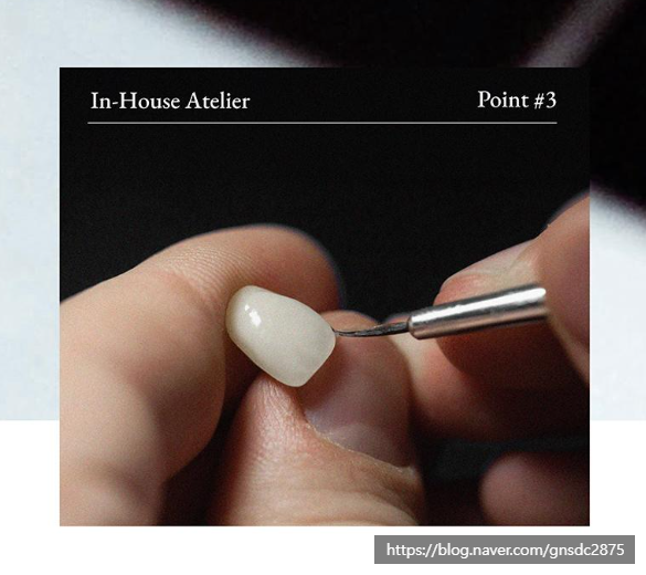 치아파절 개선방법, 뉴티스라미✨ / 강남레옹치과 관련 이미지 9