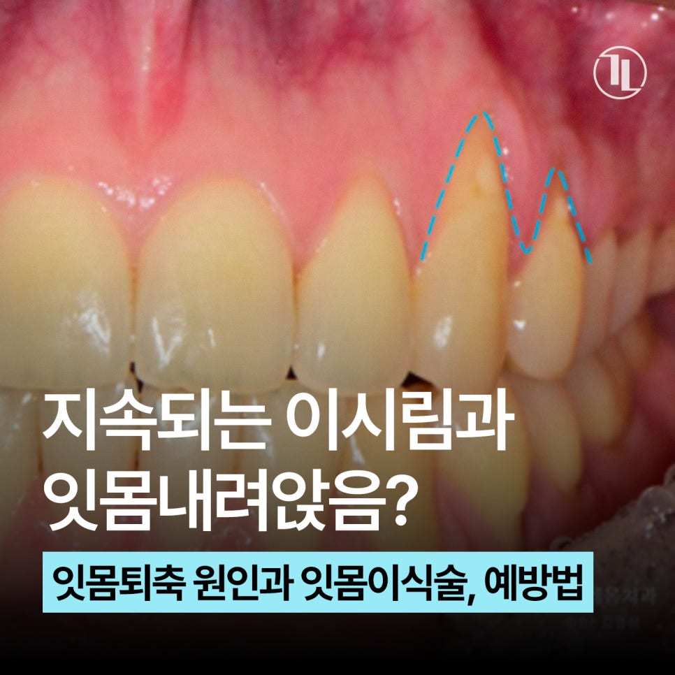 Receding Gums and Tooth Sensitivity, Gum Recession / A Complete Guide from Causes to Treatment / Gangnam Leon Dental Clinic image 1
