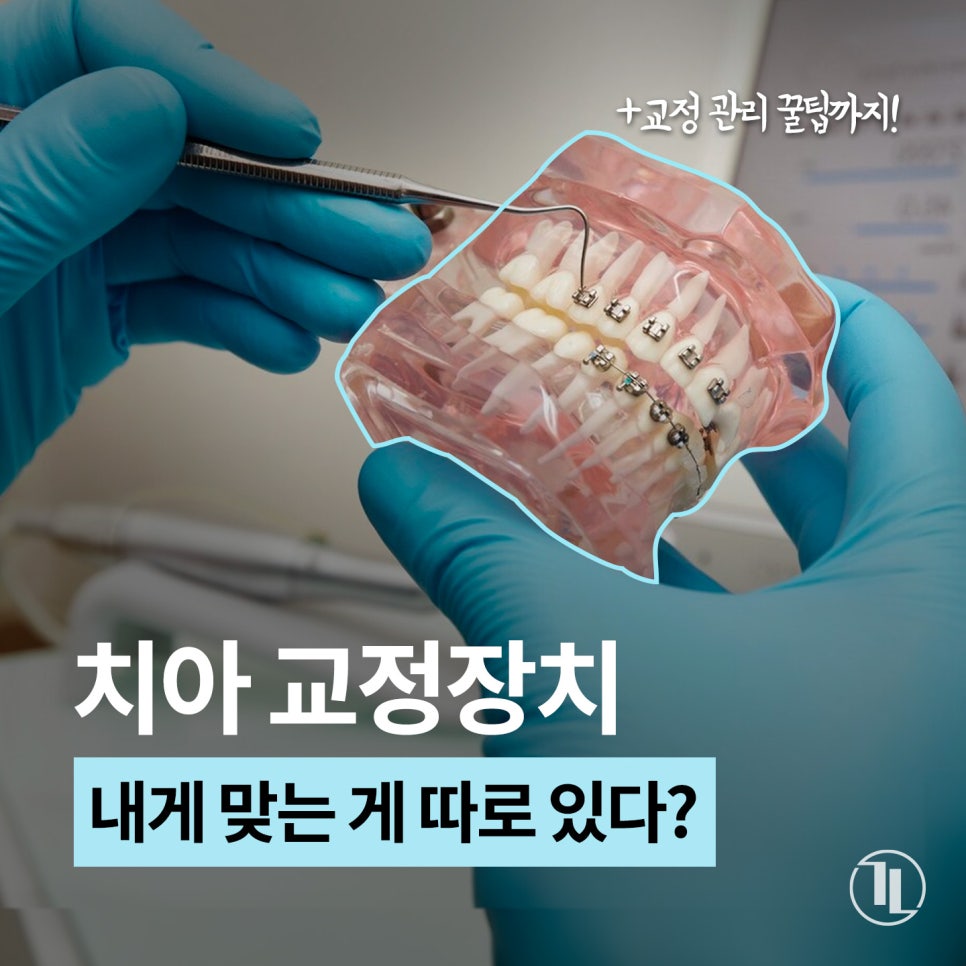 치아교정 종류와 선택법 & 관리 꿀팁 5가지!🖐️ / 강남레옹치과 관련 이미지 1