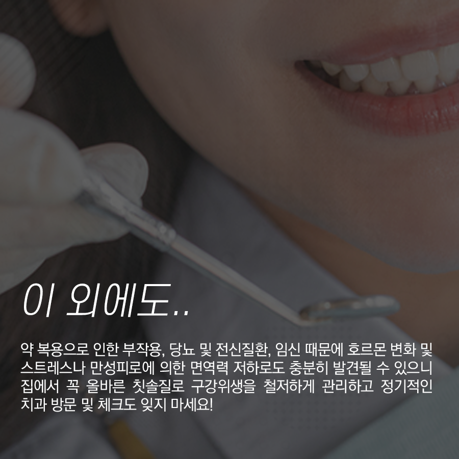 잇몸 부었을 때, 그 질환 원인과 치료법은 무엇일까요?? 관련 이미지 5