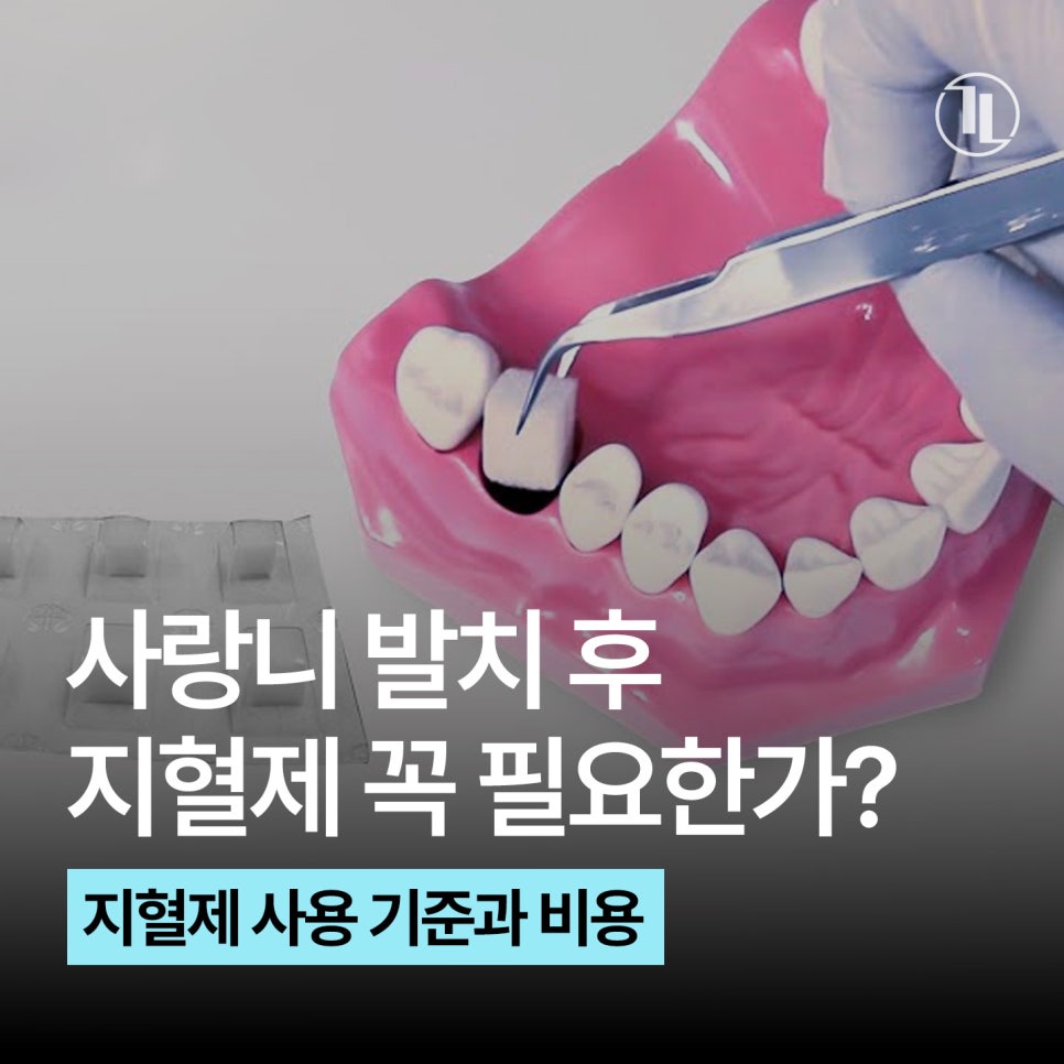 Is a Hemostatic Agent Really Necessary for Wisdom Tooth Extraction? Hemostatic Agent Usage Criteria, Insurance Coverage, and Cost / Gangnam Leon Dental Clinic image 1