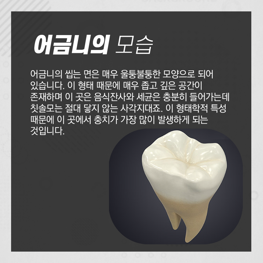 실란트 보험 적용으로 줄어든 가격! 치아 홈 메우기는 충치예방에 탁월 관련 이미지 2