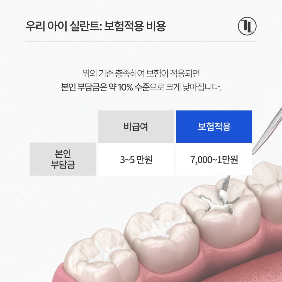 어린이 실란트, 언제 해야 할까? 시기와 보험 혜택까지 쉽게 설명 / 강남레옹치과 관련 이미지 3