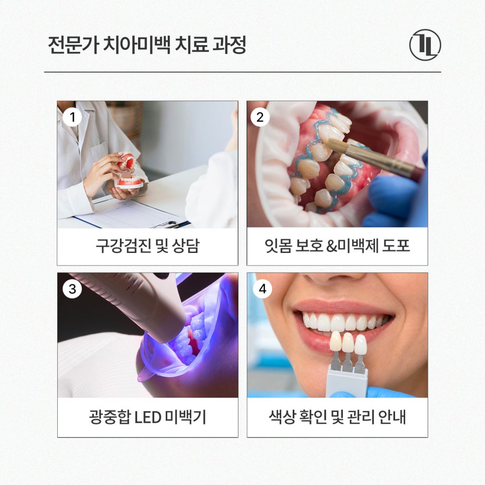 치아미백 가이드 / 비용과 효과, 셀프 미백 비교까지 / 강남레옹치과 관련 이미지 4