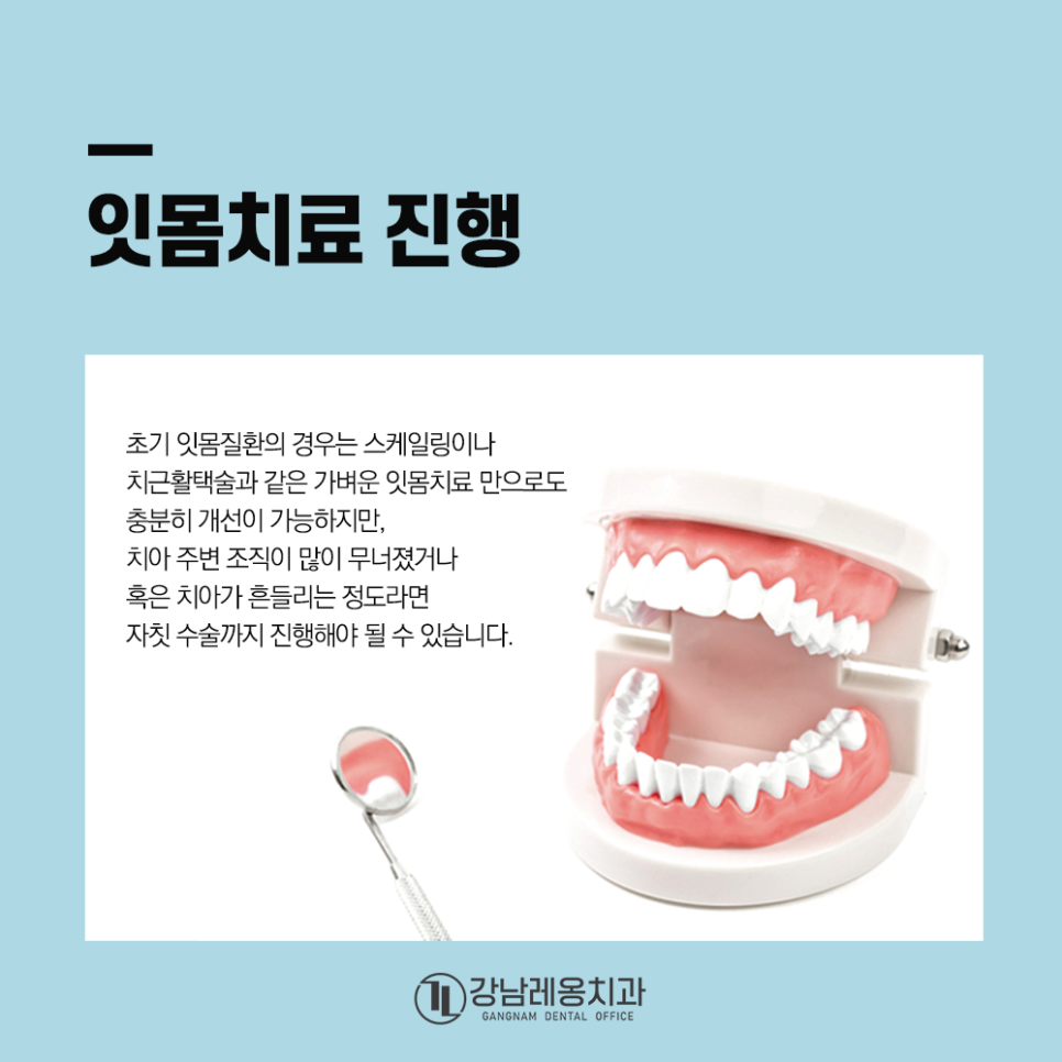 잇몸질환 자가진단법 확인하고 정기검진 다녀요! 관련 이미지 4