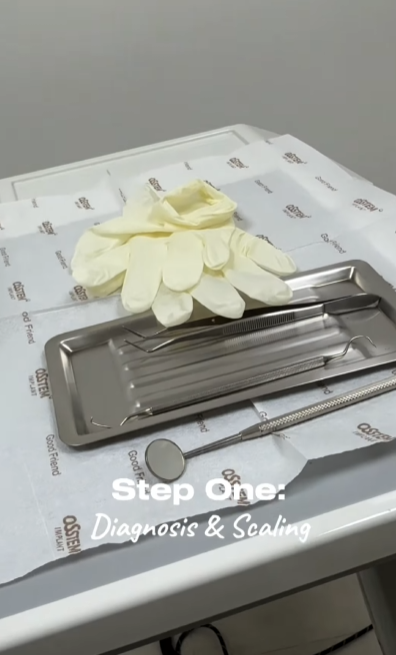 강남레옹치과 뉴티스 치아미백 Vlog📽️ | 치아미백 효과, 유지기간, 부작용 총정리! 관련 이미지 7