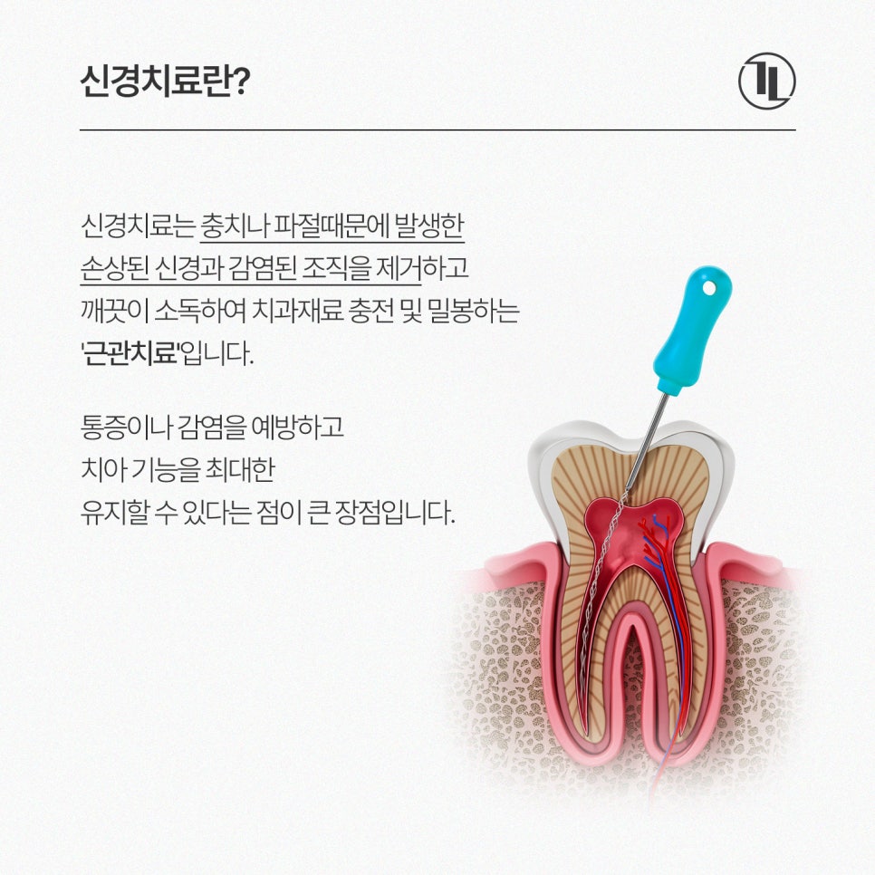찌릿한 치통? 신경치료 완전 이해하기🧐 / 강남레옹치과 관련 이미지 2