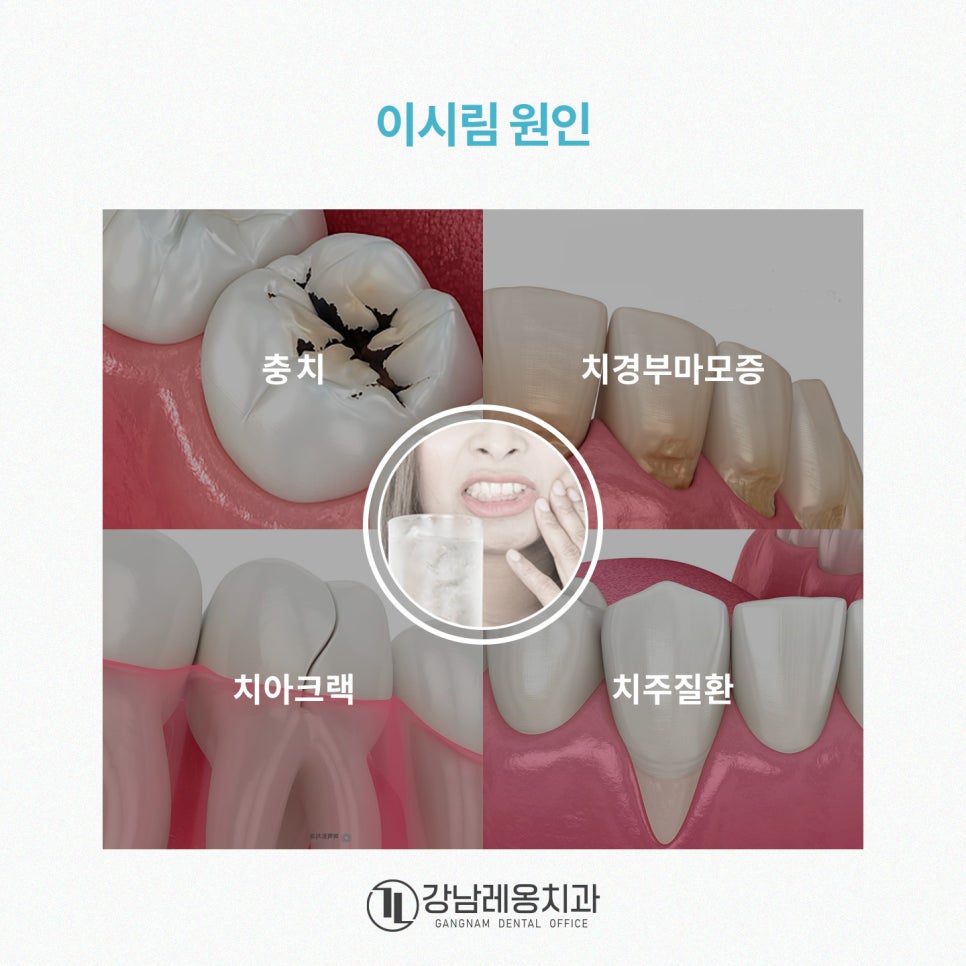 찬물 이시림 증상 원인과 치료, 시린 치아 관리 가이드🔖 / 강남레옹치과 관련 이미지 2