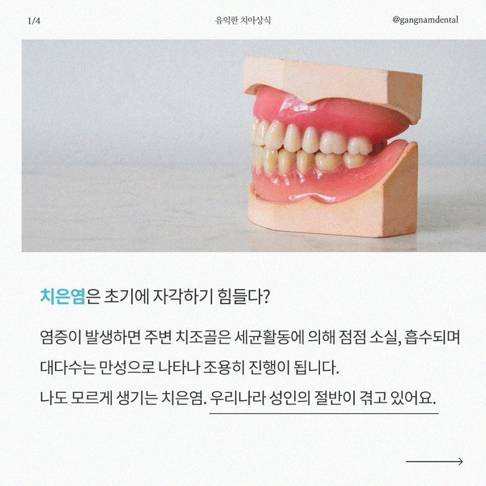 잇몸질환 자가진단 체크리스트~! / 강남레옹치과 잇몸치료 관련 이미지 2