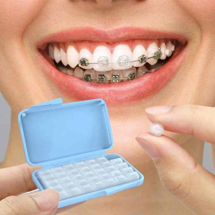 치아교정할 때 겪는 모든 문제😵 교정기 탈락, 철사 찔림, 통증 총정리!🗃️ 관련 이미지 2