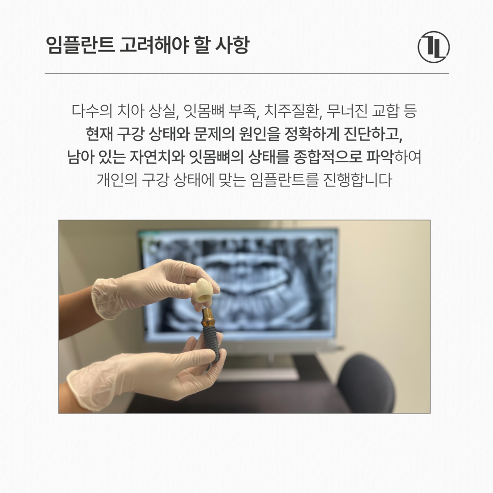 Full-Mouth Implant Treatment Case for Extensive Tooth Loss / Gangnam Leon Dental Clinic image 3