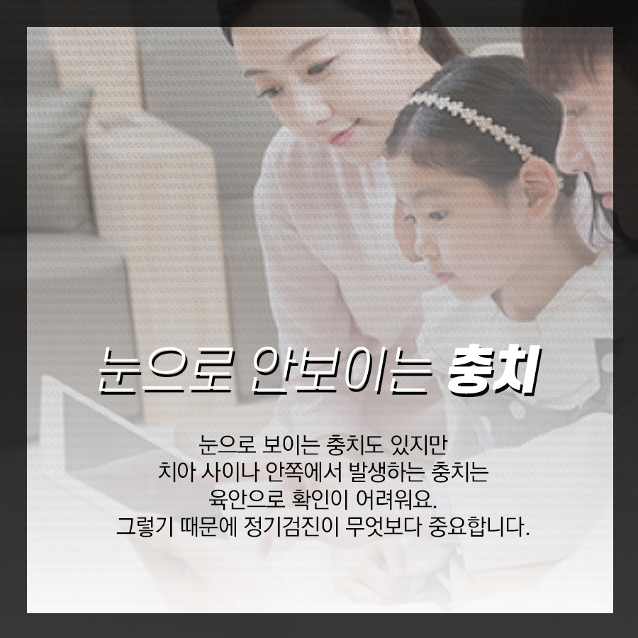 충치치료 비용이 왜 각각 다르고, 종류는 어떤 게 있을까? 관련 이미지 5