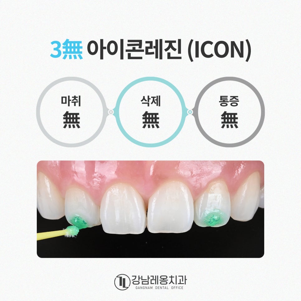 우리 아이 앞니에 하얀 반점! 소아 충치 시작의 신호? / 강남레옹치과 관련 이미지 3
