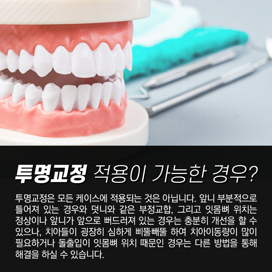 강남레옹치과 티 안나게 부정교합 변화를?! 투명교정 장단점에 관하여 관련 이미지 4