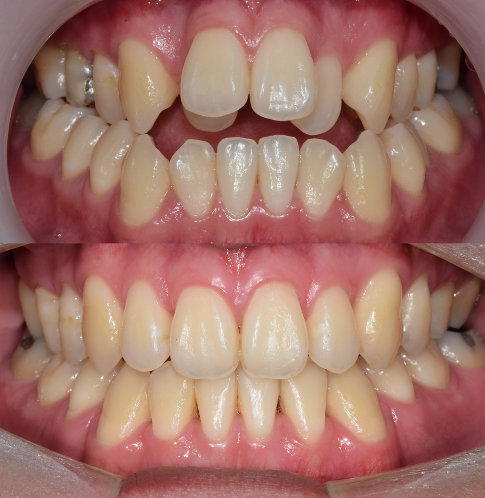 즐거운 학교 생활을 위한 강남역치과 제안~! 관련 이미지 2