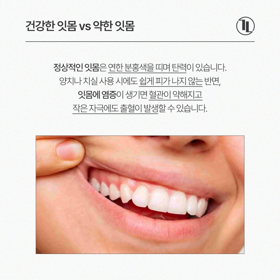 잇몸에서 피나는 사람들의 공통된 습관 4가지? / 잇몸 피 예방법 / 강남레옹치과 관련 이미지 2