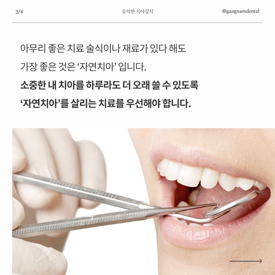 미국 MZ세대에서 유행 중인 잇몸 담배 진(ZYN)이 무엇이며, 우리 구강에 치명적인 이유는? / 니코틴이 우리 치아&잇몸에 미치는 영향은? 관련 이미지 4