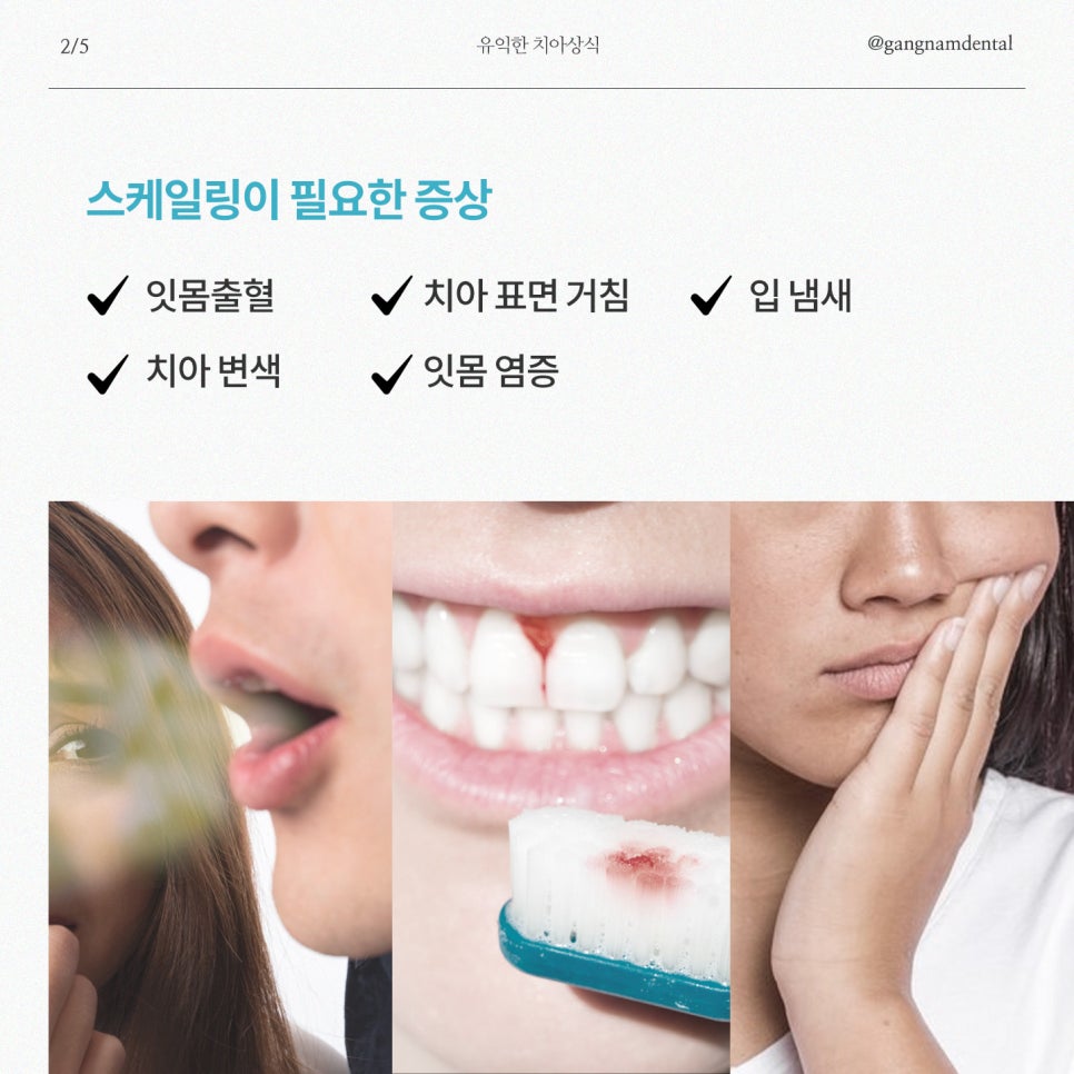 연 1회 스케일링 보험혜택 놓치지 마세요! / 주말 스케일링 / 강남레옹치과 관련 이미지 3