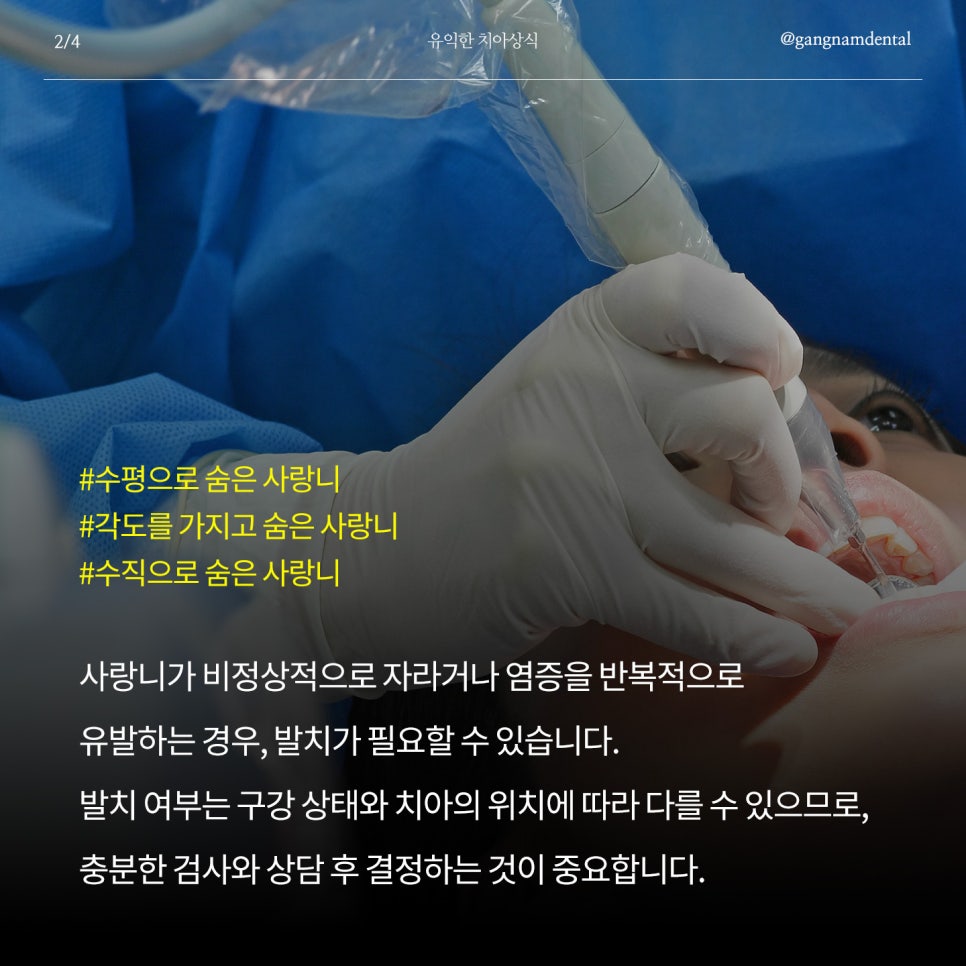 갑작스럽게 치아가 불편하거나 치과 갈 시간이 없다면? / 강남역 공휴일 치과 / 강남레옹치과 관련 이미지 3