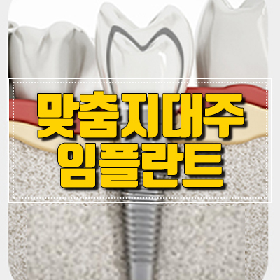 커스텀 어버트먼트 (맞춤형 지대주) 로 더 꼼꼼한 임플란트 관련 이미지 4