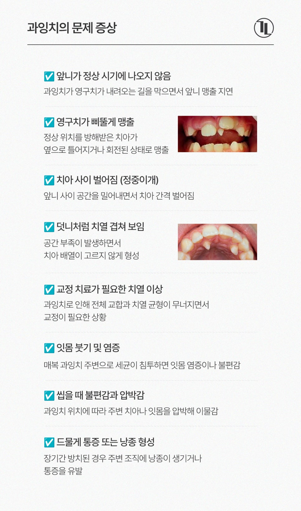 과잉치 원인부터 발치까지 / 과잉치 발치 과정 / 강남레옹치과 관련 이미지 3