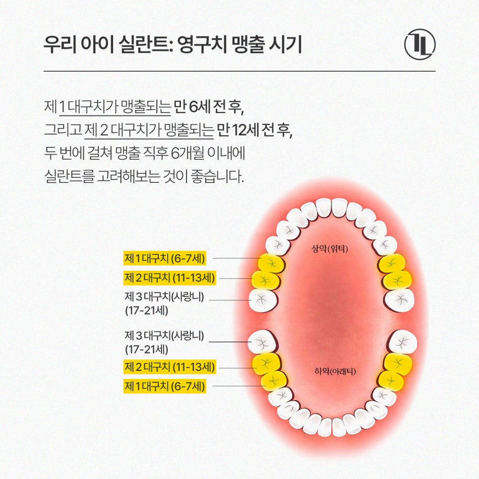 어린이 실란트, 언제 해야 할까? 시기와 보험 혜택까지 쉽게 설명 / 강남레옹치과 관련 이미지 4