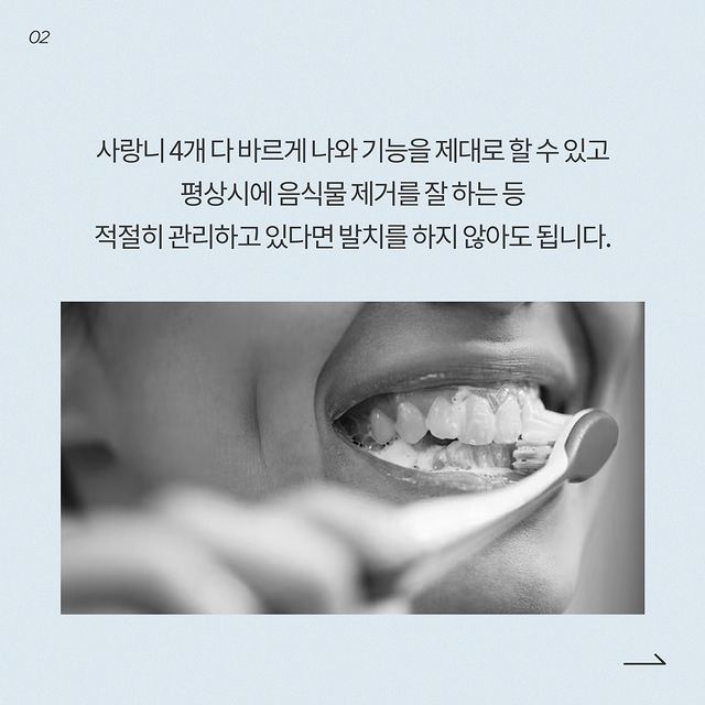 사랑니 4개 다 꼭 뽑아야 될까요? 발치 달인 강남레옹치과의 답변~ 관련 이미지 3