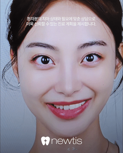 입안에서 느껴지는 딱딱한 이물감? 잇몸뼈 돌출 골융기 제거 / 강남레옹치과 관련 이미지 6