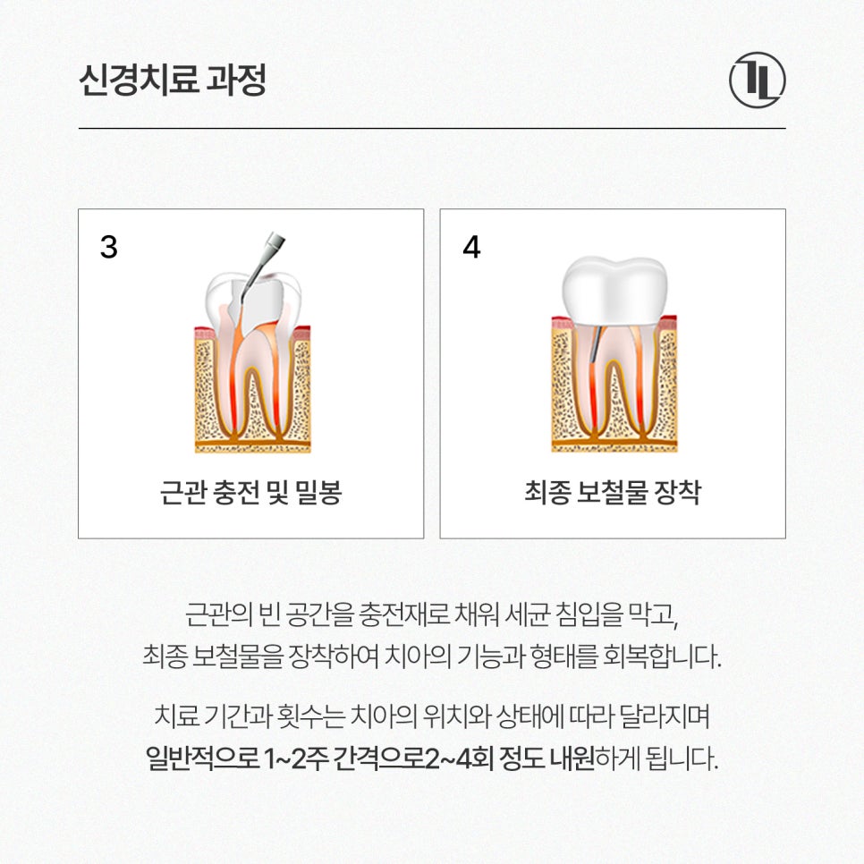 찌릿한 치통? 신경치료 완전 이해하기🧐 / 강남레옹치과 관련 이미지 5