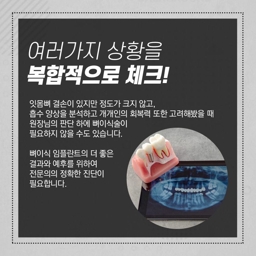 강남레옹치과 뼈이식 임플란트 수술, 어떤 경우에 해야 될까? 관련 이미지 4