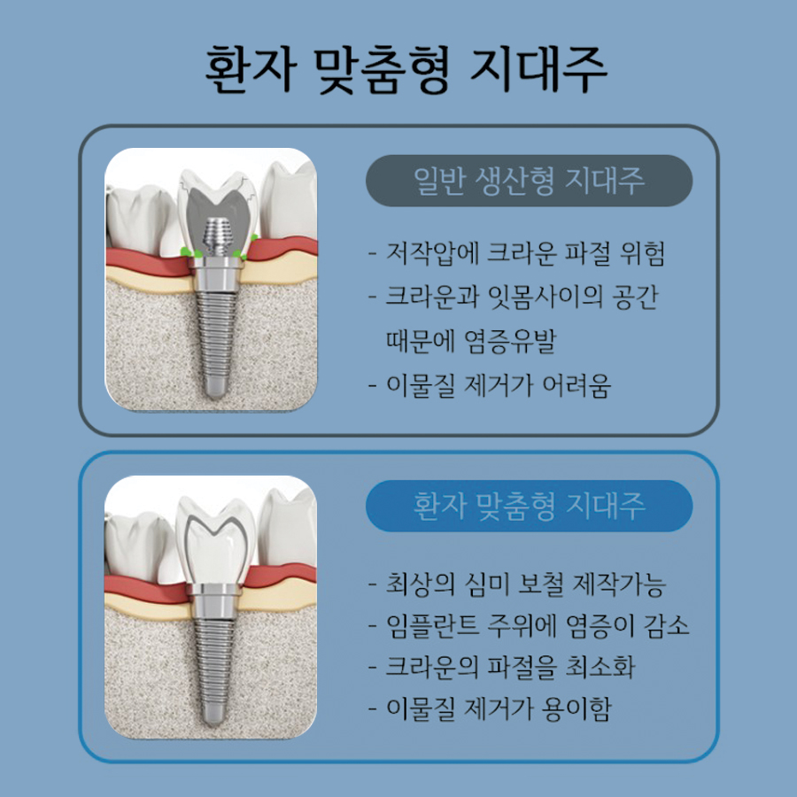 커스텀 어버트먼트 (맞춤형 지대주) 로 더 꼼꼼한 임플란트 관련 이미지 1