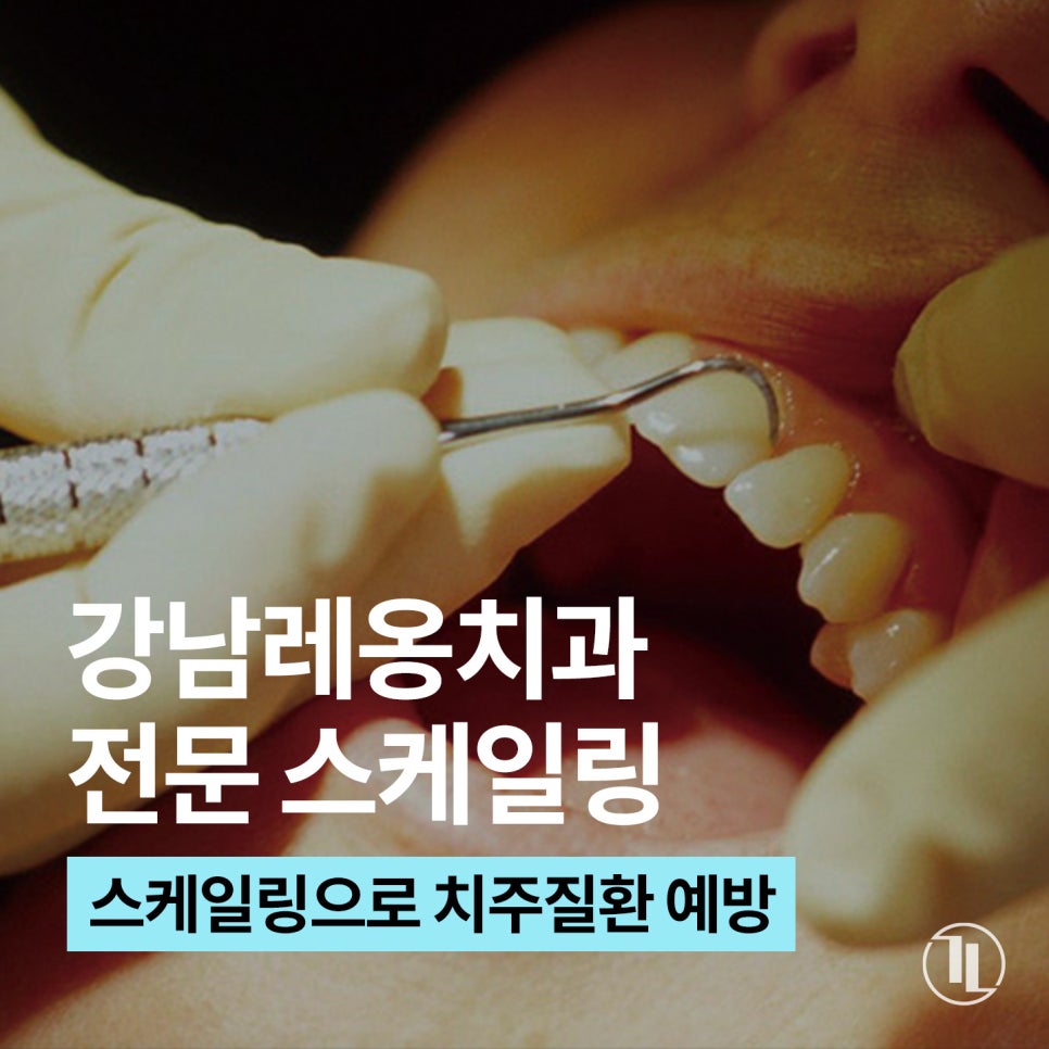 강남역 스케일링 맛집 / 치석 제거와 잇몸 건강의 핵심! / 핸드 스케일링 강남레옹치과 관련 이미지 1