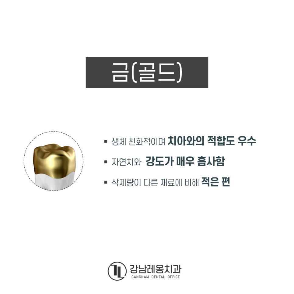 신경치료 후 남아 있는 자연치아 보호를 위한 &lsquo;크라운 치료&rsquo;의 종류와 특징은? 관련 이미지 4