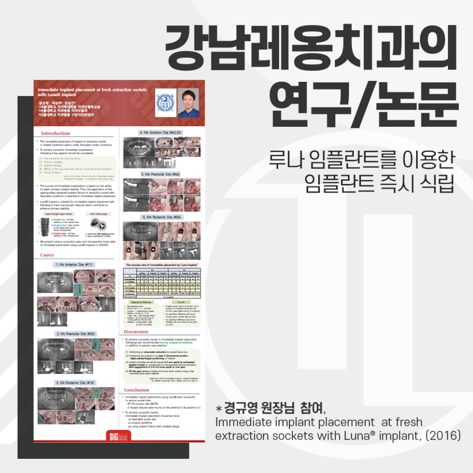 발치 즉시 임플란트 식립에 관한 논문에 참여 관련 이미지 1