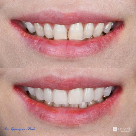 Aesthetic Dentistry A to Z, 박영민 원장님의 앞니치료 세미나 스케치🎤 관련 이미지 7