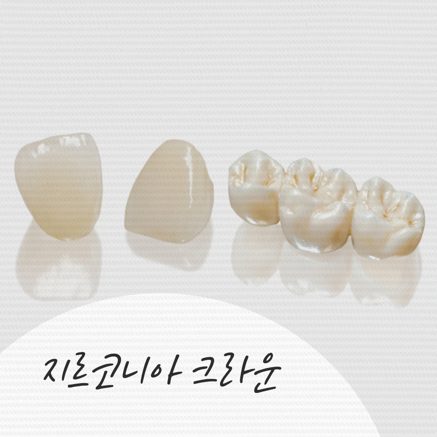 크라운치료 비용, 각자 특징과 장단점이 달라요. 관련 이미지 5