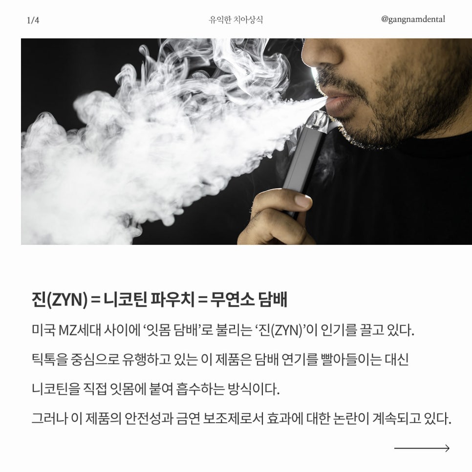 미국 MZ세대에서 유행 중인 잇몸 담배 진(ZYN)이 무엇이며, 우리 구강에 치명적인 이유는? / 니코틴이 우리 치아&잇몸에 미치는 영향은? 관련 이미지 2