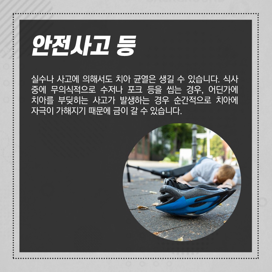 치아크랙? 치아에 금이 가는 이유, 균열 생겼을 때 증상 관련 이미지 4