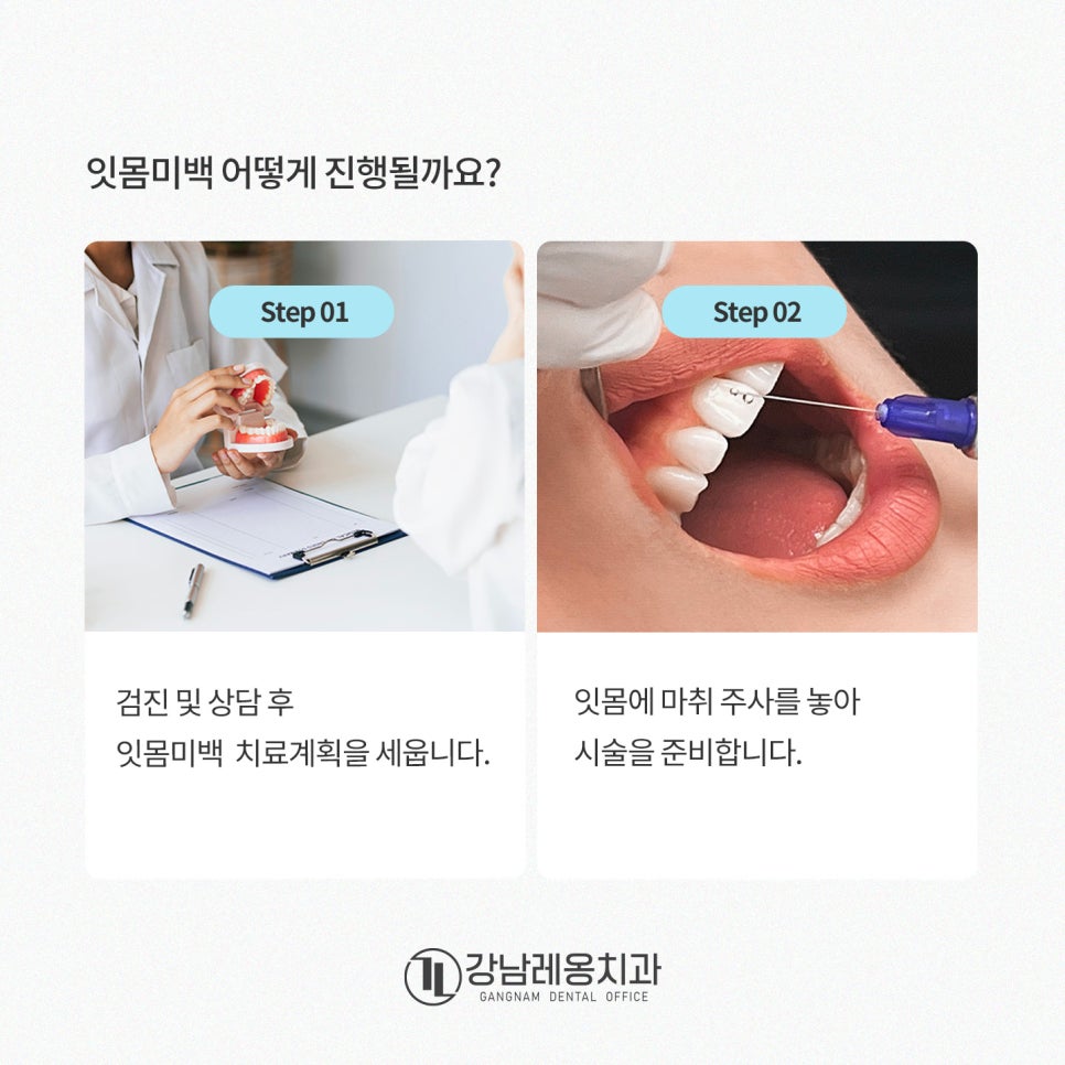 잇몸도 화이트닝이 된다? 까만 잇몸, 착색 잇몸 미백 / 강남레옹치과 관련 이미지 3