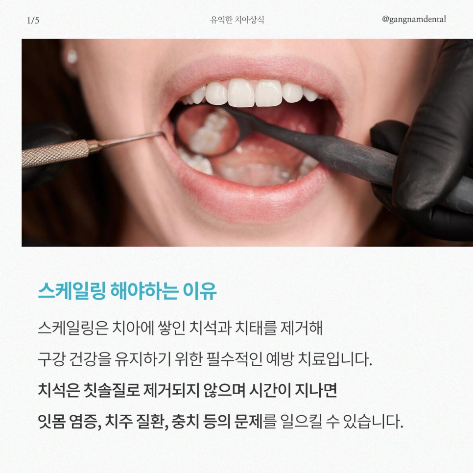 연 1회 스케일링 보험혜택 놓치지 마세요! / 주말 스케일링 / 강남레옹치과 관련 이미지 2
