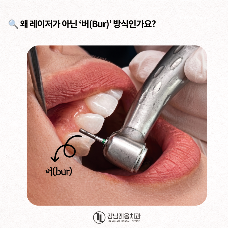 Concerned About Dark Gums Showing When You Smile? Gum Whitening Procedure Effects, Duration, and Precautions! / Gangnam Leong Dental New-Teeth Gum Whitening image 5