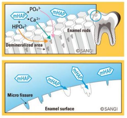 충치예방부터 시린이 완화까지! 아파프로 치아영양제의 5가지 효과✨ / 강남레옹치과 관련 이미지 5