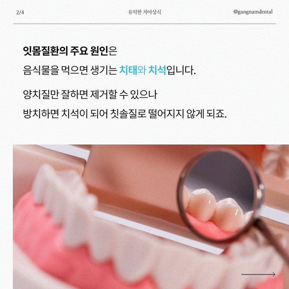 잇몸질환 자가진단 체크리스트~! / 강남레옹치과 잇몸치료 관련 이미지 3