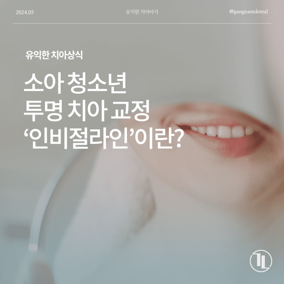 소아 청소년 치아교정의 필요성과 관련 이미지 1