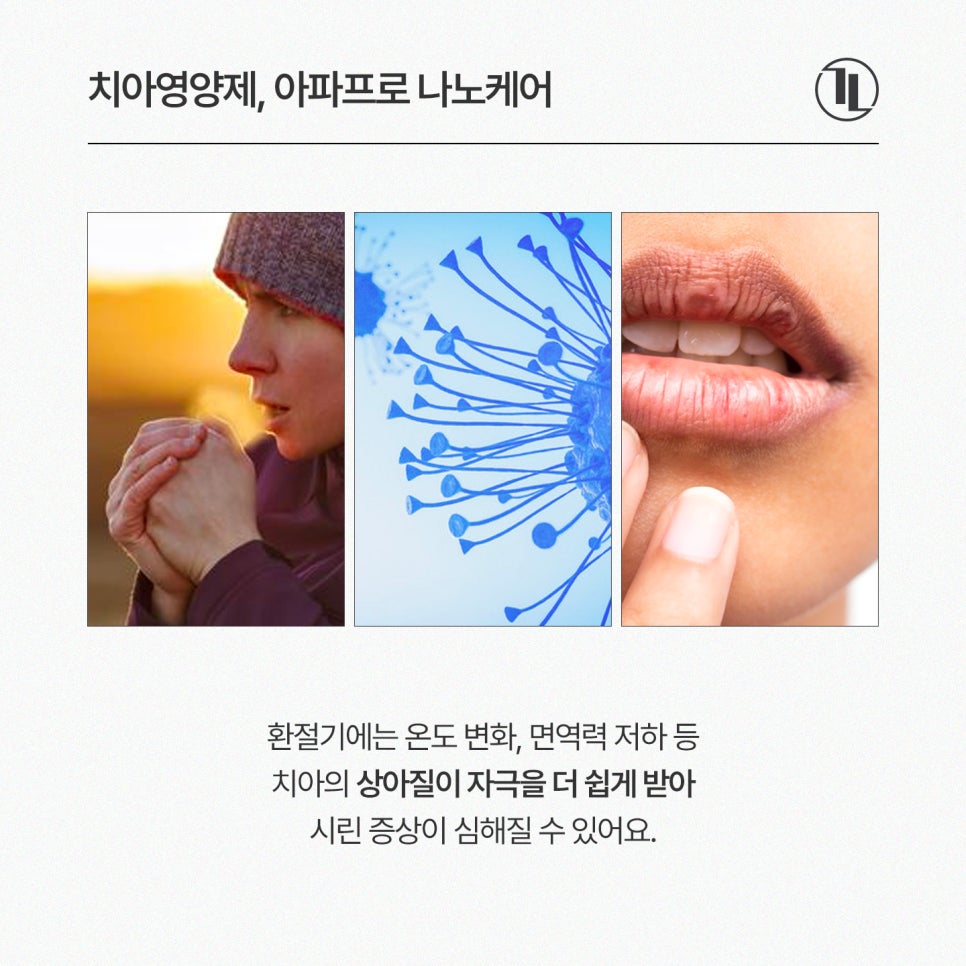 환절기 치아 시림, 아파프로 나노케어로 민감성 치아 관리하기 / 강남레옹치과 관련 이미지 2