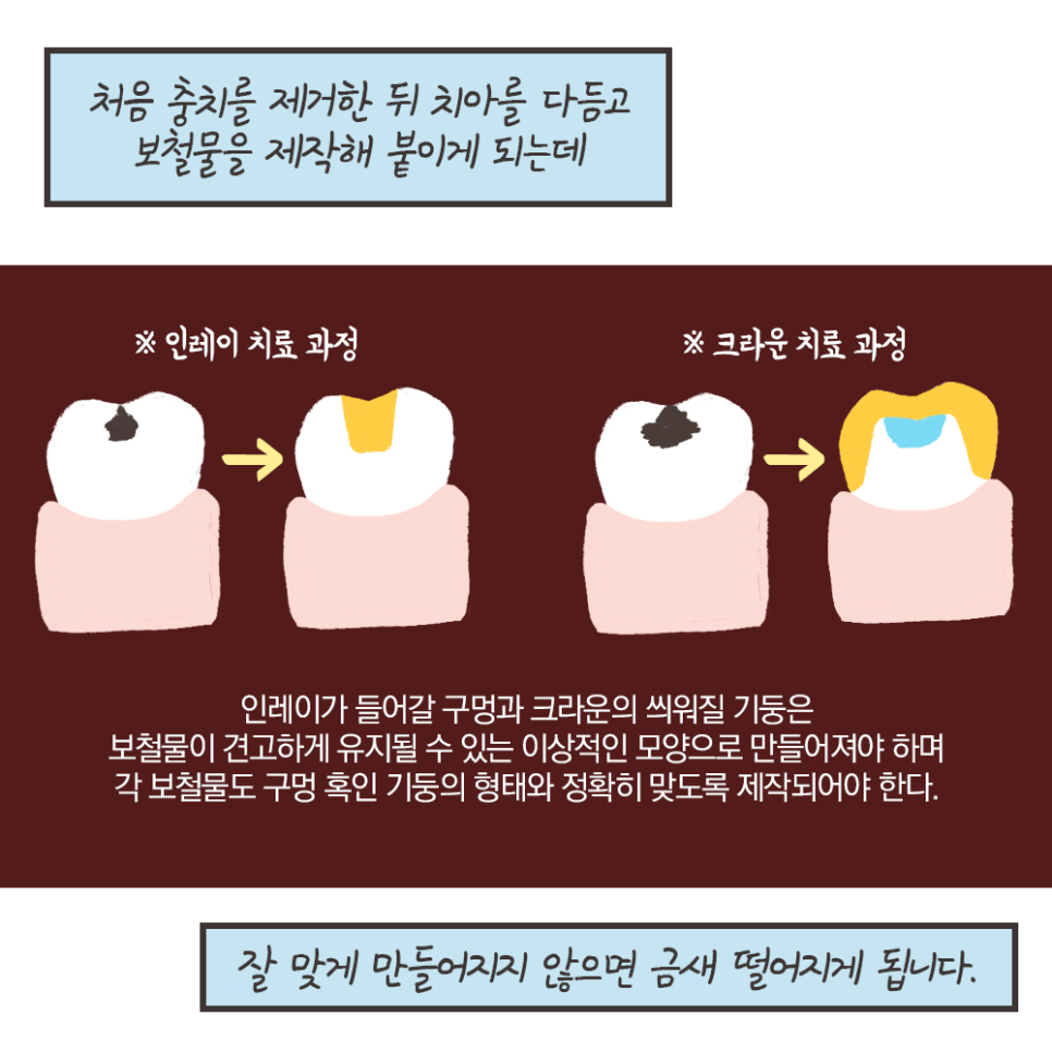 떨어진 금니 다시 붙일 수 있을까? - 보철물 탈락 이유, 대처법 (냐폴레옹 치과툰) 관련 이미지 6